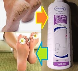 #7: Потріскані п&acute;я