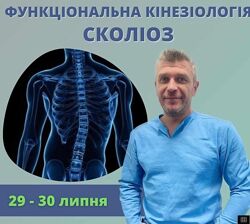 Функциональная кинезиология Сколиоз Дмитрий Кущик
