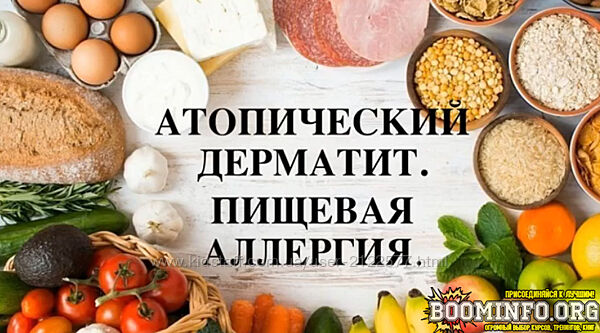 Регина Доктор Атопический дерматит Пищевая аллергия