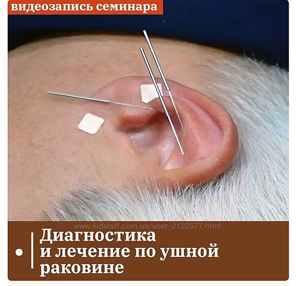 Владимир Кононов Диагностика и лечение по ушной раковине Лечение зависимост