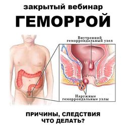 Женя Братишка , Юля Братишка  Геморрой 2024