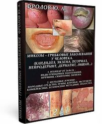 Методики излечения от грибковых заболеваний, кожных и внутренних поражений 