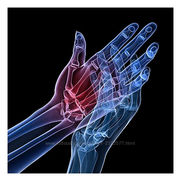 Вячеслав Пичугин Дисфункции лучезапястного сустава и кисти 