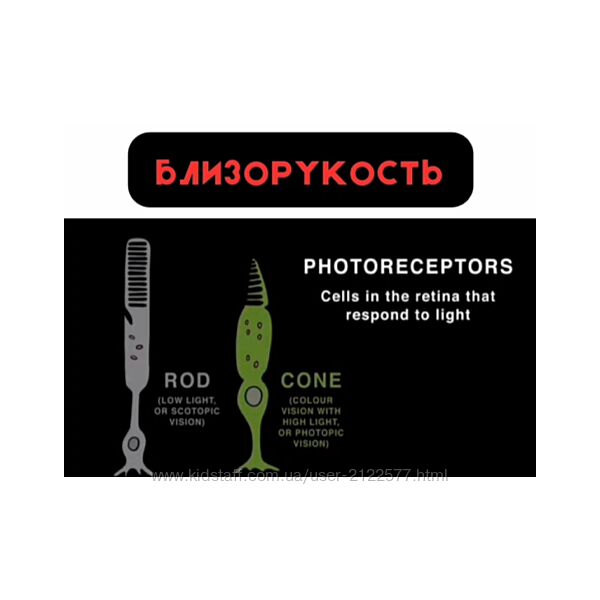 Артур Мазаев Близорукость с точки зрения холистического врача 2025