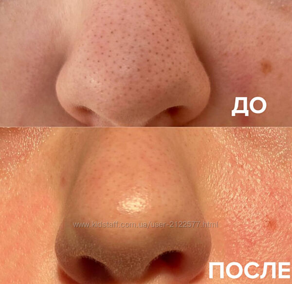 Гайд по чистой коже Blur face Наталья Bbos 2024