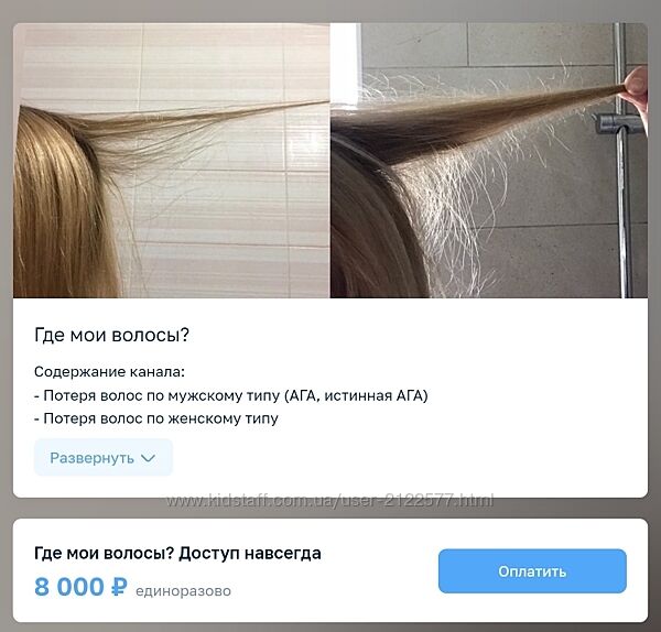 Ирина Заяц Где мои волосы 2025